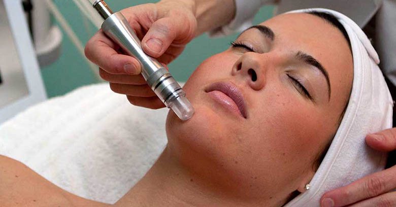 Microdermabrasion