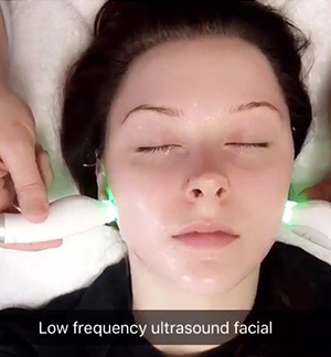woman having a low frequency ultrasound facial treatment done