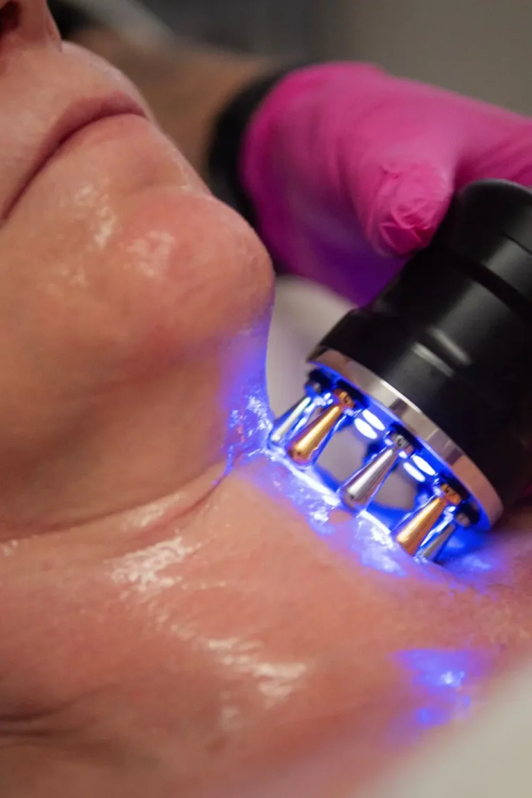 Cold Laser Light Therapy Being Used on Womans Neck for Wrinkle Reduction