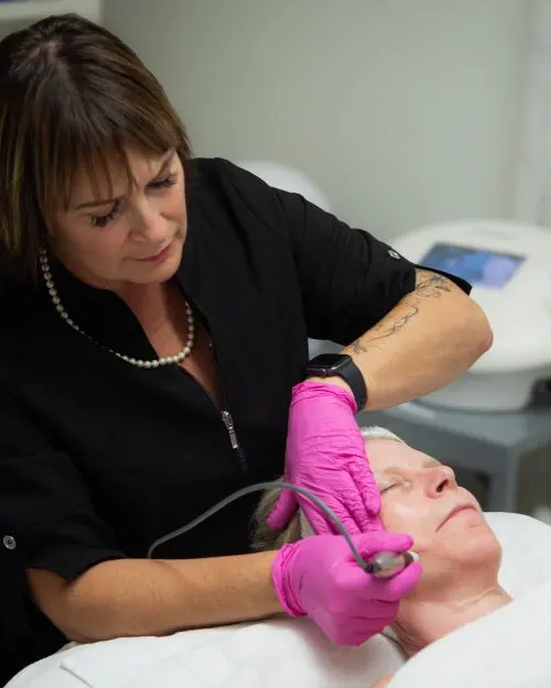 Esthetician Performing Microneedling Facial
