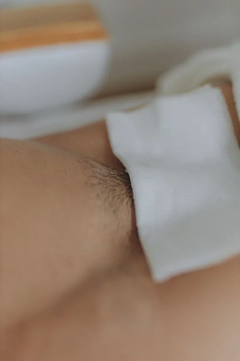 Waxing Pubic Hairline for Bikini or Brazilian Wax